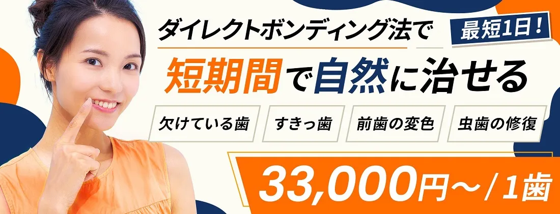 ダイレクトボンディング